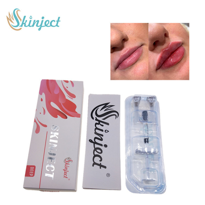Llenadores cutáneos ácidos hialurónicos profundos de los labios 2ml de Skinject inyectables