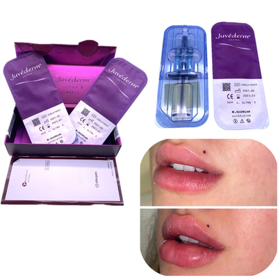 El aumento del labio de Juvederm 2x1ml del llenador de la ha de la inyección quita arrugas