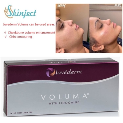 Inyectable cutáneo ácido hialurónico de los llenadores del labio del cuidado 2x1ml Juvederm de la cara