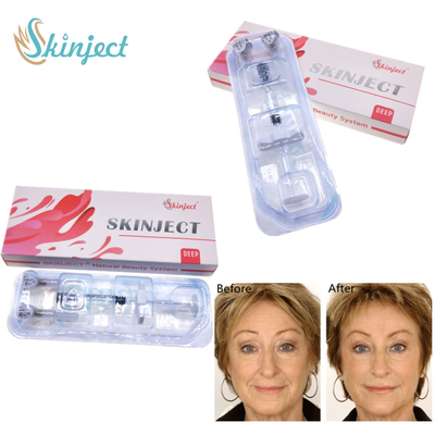 Llenador cutáneo del labio de la inyección para las arrugas y los dobleces faciales profundos