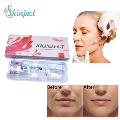 Llenador cutáneo del labio de la inyección para las arrugas y los dobleces faciales profundos