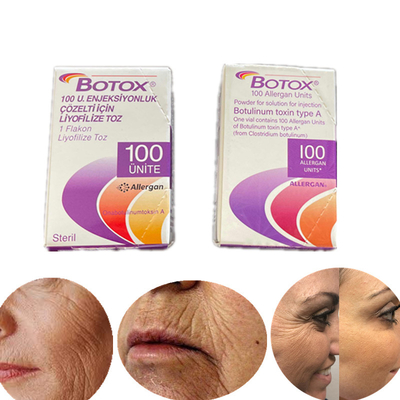 Tipo de la edición inglesa una toxina Botulinum 100 Iu Allergan  para las arrugas