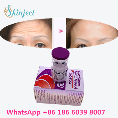 La toxina Botulinum  arruga el retiro 100u Allergan 100 unidades para la inyección del lifting facial