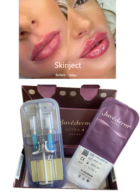 Mejilla cutánea ácida hialurónica profunda inyectable Chin Nasolabial Fold del llenador del labio 2ml