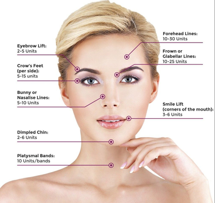La frente alinea los llenadores cutáneos antis de Botulax  de la arruga Botulinum para el lifting facial