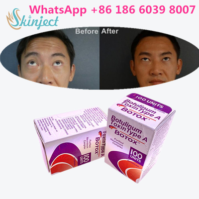 Toxina Botulinum Allergan s 1x100iu para las arrugas faciales