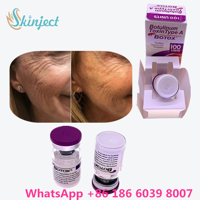 Frasco/caja Botulinum de Allergan  100 Iu 200ui 1 de la toxina