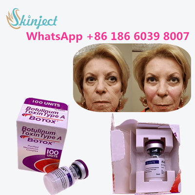 La toxina Botulinum original  100u del 100% para quita arrugas
