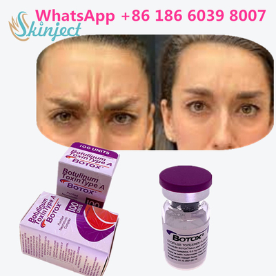 La toxina Botulinum original  100u del 100% para quita arrugas