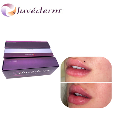 Llenador cutáneo inyectable Ultra3 Ultra4 Voluma para el labio del pómulo