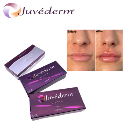 Hyluronic Acid Dermal Filler Premium Juvederm HA Facial Filler Ultra3 Ultra4 Volumen para el rejuvenecimiento de la cara