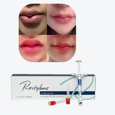 Juvederm Enlace cruzado de relleno cutáneo inyectable para labios