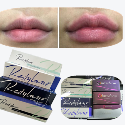 2*1ml/ Caja Relleno dérmico de ácido hialurónico para aumento de labios