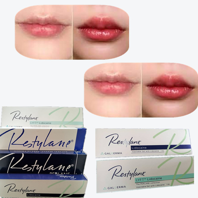 2*1 ml/ Caja Relleno cutáneo de enlace cruzado para aumento de labios