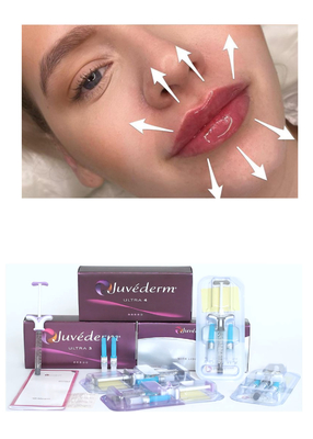 Juvederm' Ácido hialurónico Relleno dérmico Ultra3 Ultra4 Inyección de volumen para llenado de labios