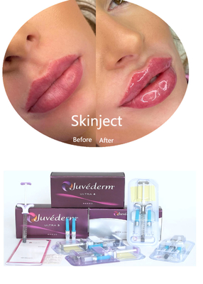 Juvederm Ácido hialurónico Relleno cutáneo facial inyectable 2*1 ml Embalaje
