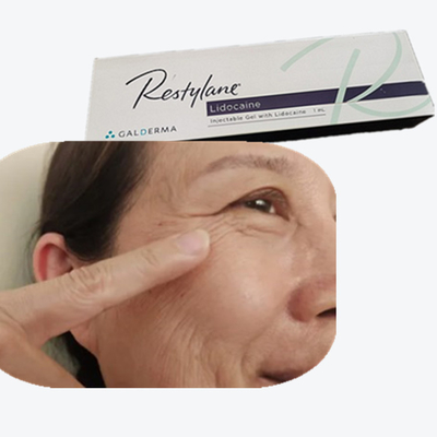 2*1ml/ Caja Relleno de pecho con ácido hialurónico HA Relleno dérmico para líneas de la frente