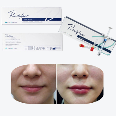 Injectable Dermal Filler 2x1ml Voluma Hyaluronic Acid Facial Filler for Face Injection