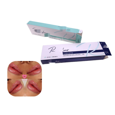 Gel de ácido hialurónico cruzado 1 ml de inyección de relleno antiarrugas