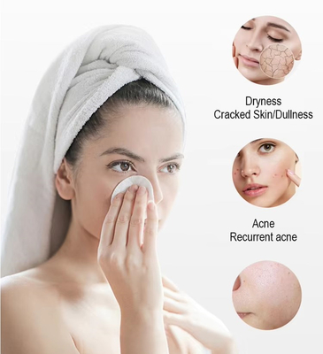 Nueva llegada Perla Negra 10 en 1 Máquina de exfoliación Hydra Máquina de microdermoabrasión Facial Spa Micro-Touch Hydra Cuidado de la piel