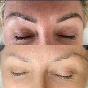 Extirpación de cejas Extirpación de vello Máquina de belleza láser 810nm Máquina de extirpación de tatuajes láser