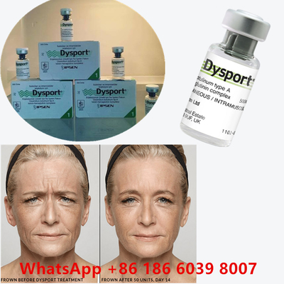 Toxina botulínica 100 unidades BTX inyección tipo A Uso cosmético