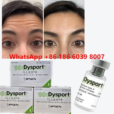 Toxina Botulínica Dysport 100u Clostridium Botulinum Tipo A Para el rostro anti-envejecimiento