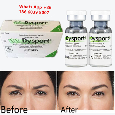 Toxina Botulínica A Dysport Inyectable Botox Para Aumento de Mentón