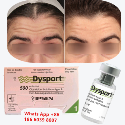 Inyección antiarrugas de toxina botulínica tipo A Dysport para líneas periorales