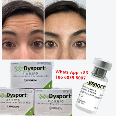 Toxina Botulínica Dysport en Polvo Liofilizado Anti-arrugas para Adelgazar el Rostro