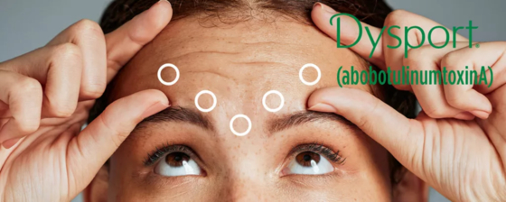 Dysport 500 para inyección abobotulinumtoxinA Botox 500U