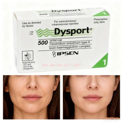 Toxina Botulínica 500U Dysport Reduce las Arrugas Faciales y Restaura la Suavidad de la Piel
