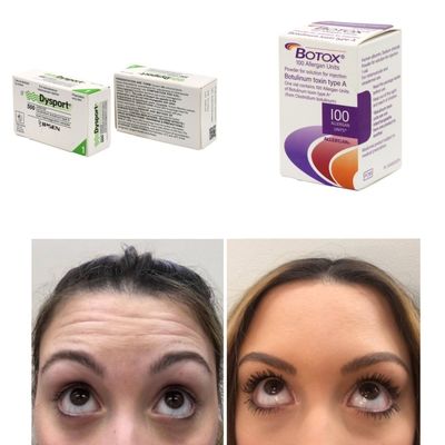 100 unidades Corea BTX Toxina botulínica para arrugas y líneas finas