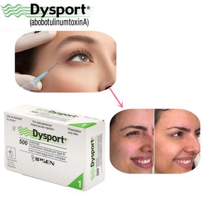 500u Dysport Disparición de Arrugas Faciales Polvo Liofilizado Procesamiento Personalizado OEM Dysport