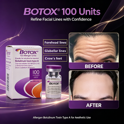 Botox 100 unidades inyección antiarrugas tratamiento facial estética alérgico toxina botulínica tipo A