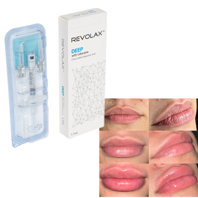 Revolax Ácido hialurónico Relleno dérmico Limpieza natural Aumento de labios Restauración del volumen facial