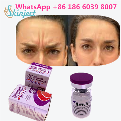 Toxina Botulínica BOTOX Cosmético 100 Unidades Allergan OnabotulinumtoxinA para Arrugas Faciales