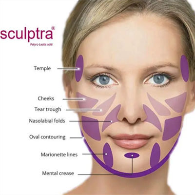 El polvo de  PLLA del CE para estimula el colágeno