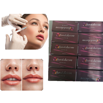 Llenador cutáneo ácido hialurónico Juvederm del llenador del gel del labio ultra 3 ultra 4