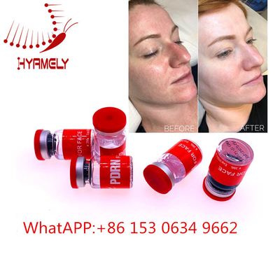 Inyección meso antienvejecedora del suero con Hyaluron Pen Dermal Filler