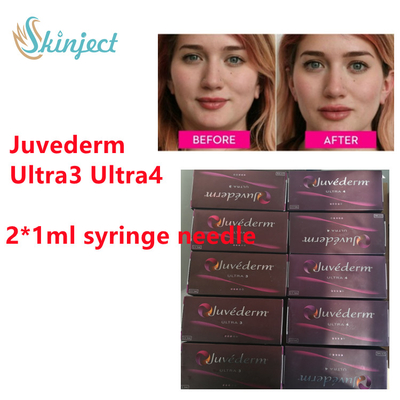 Llenador cutáneo ácido hialurónico del labio de Juvederm del llenador de Juvederm con la lidocaína 2x1ml Ultra3 Ultra4