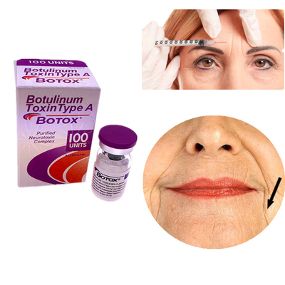 Allergan Botox 100IU Toxina Botulínica Tipo A para la eliminación de arrugas en la cara y los ojos