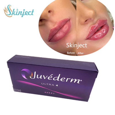 Llenador cutáneo ácido hialurónico del llenador de los labios de Juvederm 2*1ml con Lido Ultra4