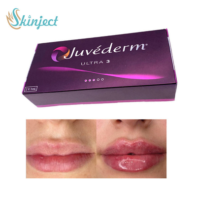 Llenador ácido hialurónico Juvederm Ultra3 del labio 281ML cutáneo