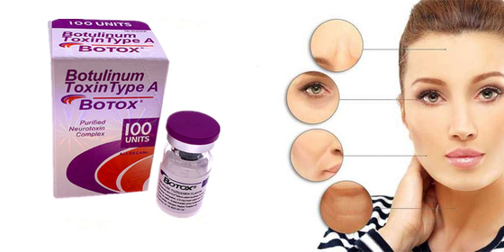 Tipo Botulinum de la toxina de Allergan una forma del polvo de