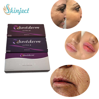 Juvederm ultra 4 inyecciones cutáneas del labio del llenador para el aumento atractivo de los labios