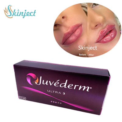 Llenadores faciales ácidos hialurónicos de Juvederm Ultra3 2x1ml cutáneos