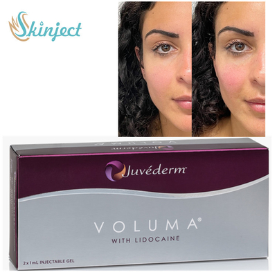 Llenadores cutáneos de Juvederm Voluma 2x1ml ha para el pómulo Chin Contouring