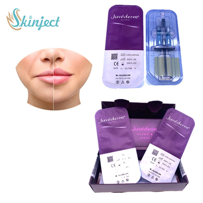 Ácido hialurónico de los llenadores cutáneos de la ampliación del labio de Juvederm Ultra4