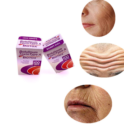 Crezca las líneas quitan Allergan 100 IU de toxina Botulinum para las líneas de la frente